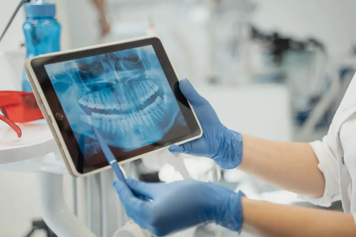 Medic care analizează o radiografie dentară pe tabletă, cu mănuși de protecție albastre