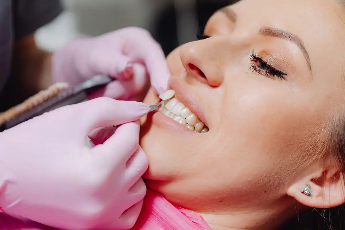 Medic probează o fațetă dentară pe dinții unei paciente aflate în fotoliu