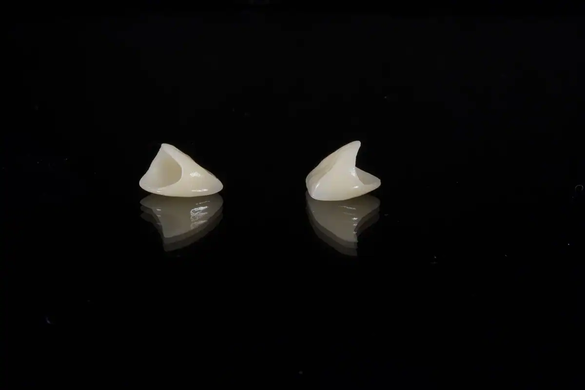 Două fațete dentare ceramice albe așezate pe o suprafață neagră