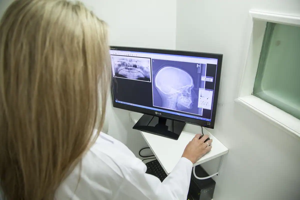 Medic privește pe ecranul calculatorului radiografia craniului unui pacient