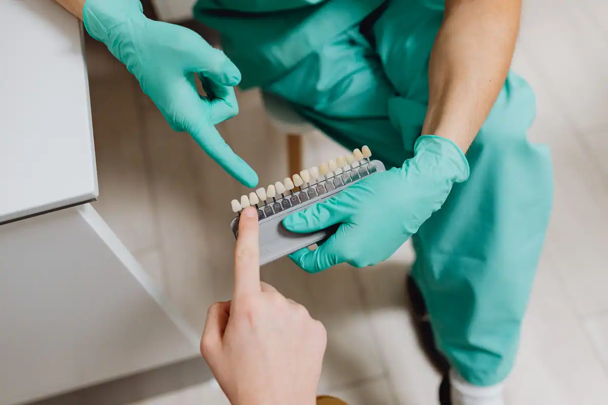 Medic cu mănuși ține o scală de culori lângă dinții pacientului, pentru alegerea nuanței