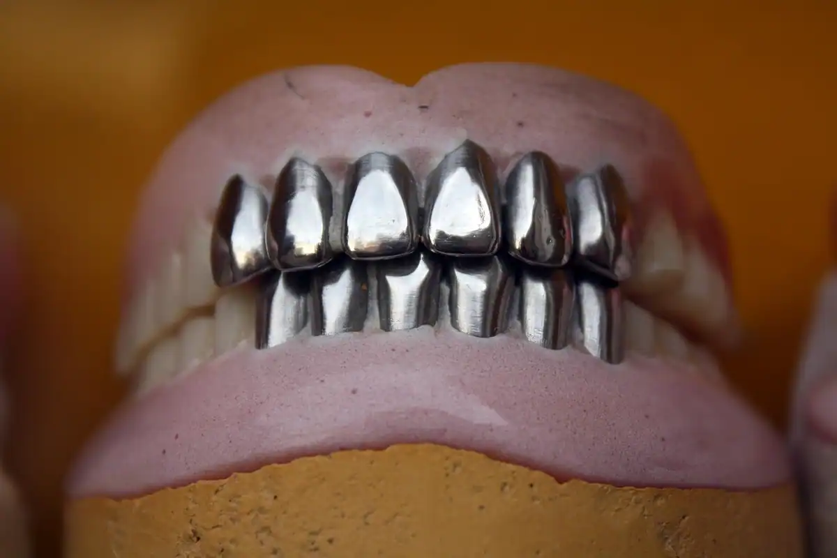 Proteză dentară cu dinți metalici strălucitori, pe bază roz